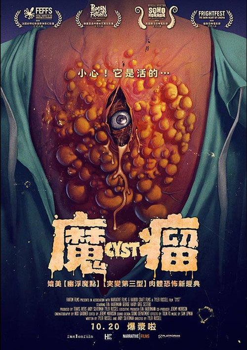 囊肿